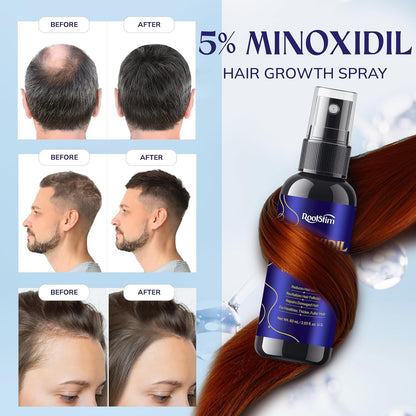 Strong Hair Regrowth Serum for Men and Women