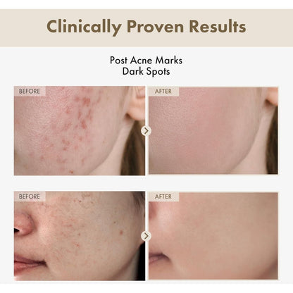 Natural Brightening Face Serum 33ml