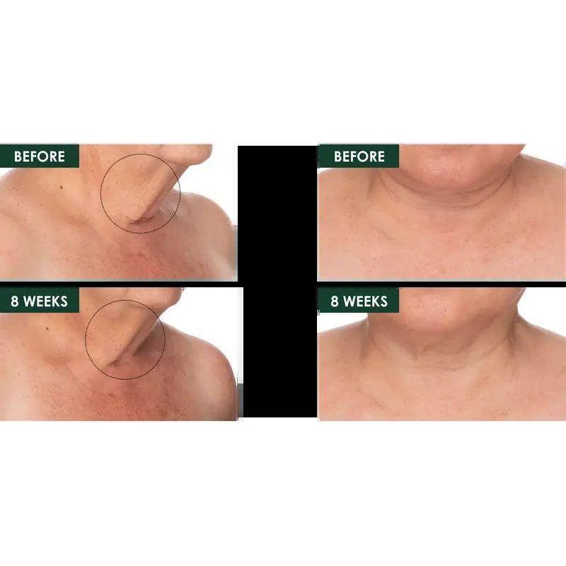 Anti Aging Neck Serum 50ml Firming & Lifting Treatment