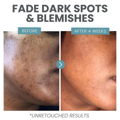Natural Vitamin C Face Serum for Clear Skin - 30ml