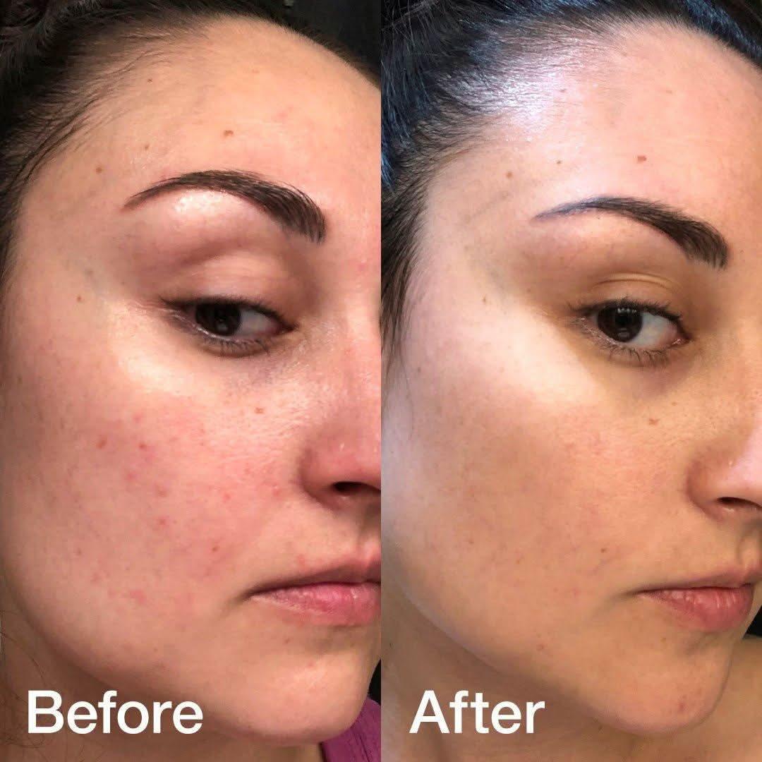 Hydrating Glass Skin Serum Set