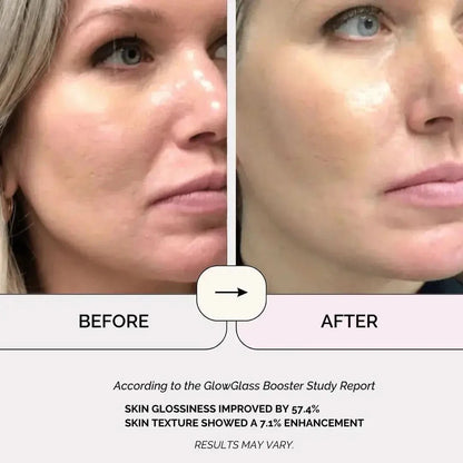Advanced LED Facial Skin Care Light Therapy Wand