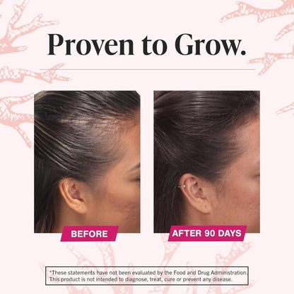 Natural Hair Growth Vitamin Supplement Tablets
