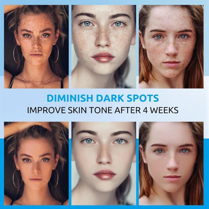 Effective Dark Spot Remover Face and Body Cream