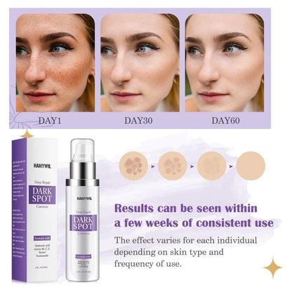 Intensive Dark Spot Remover Cream for Face & Body