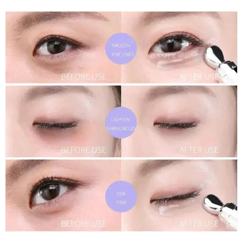 Anti Aging Eye Cream - Reduces Dark Circles 15ml