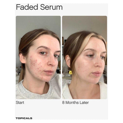 Razor Burn & Dark Spot Removal Cream Set