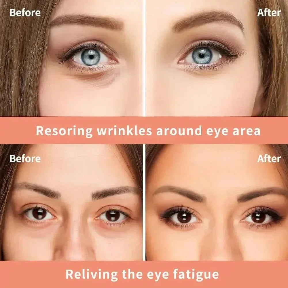 Anti Aging Wrinkle Eye Cream