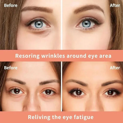 Anti Aging Wrinkle Eye Cream