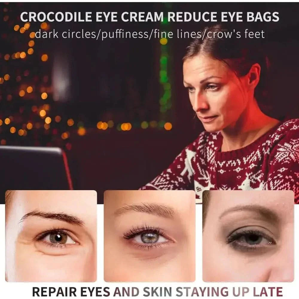 Anti Aging Wrinkle Eye Cream