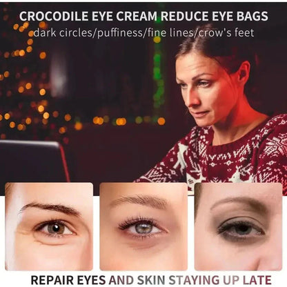 Anti Aging Wrinkle Eye Cream