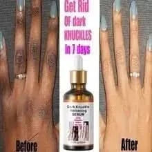 Brightening Hand Serum for Glowing Skin