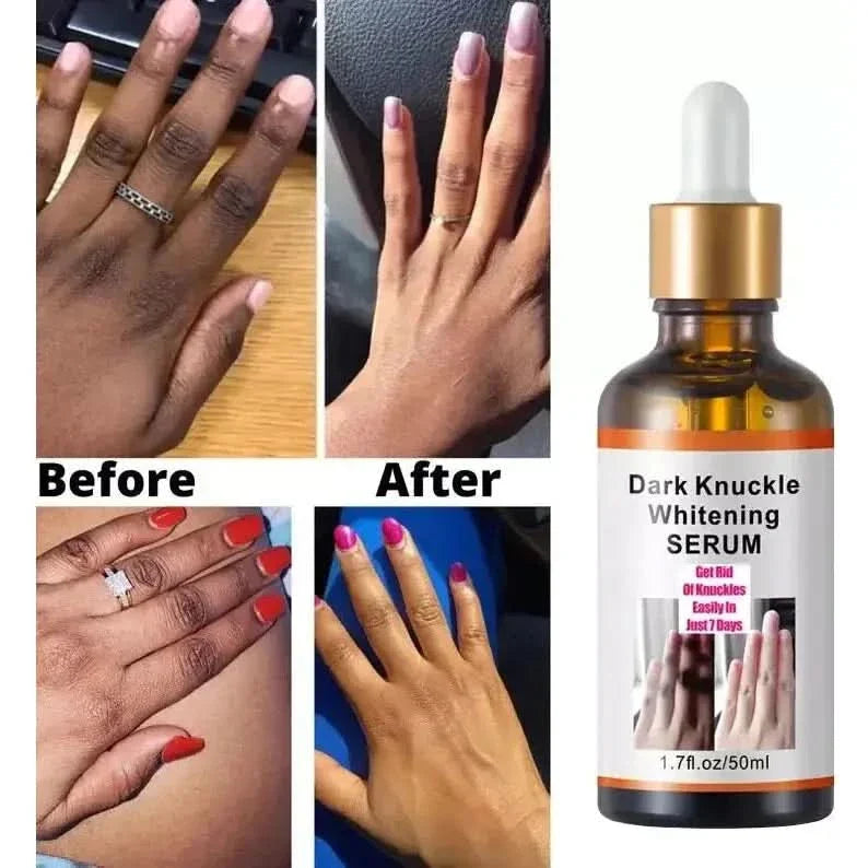 Brightening Hand Serum for Glowing Skin