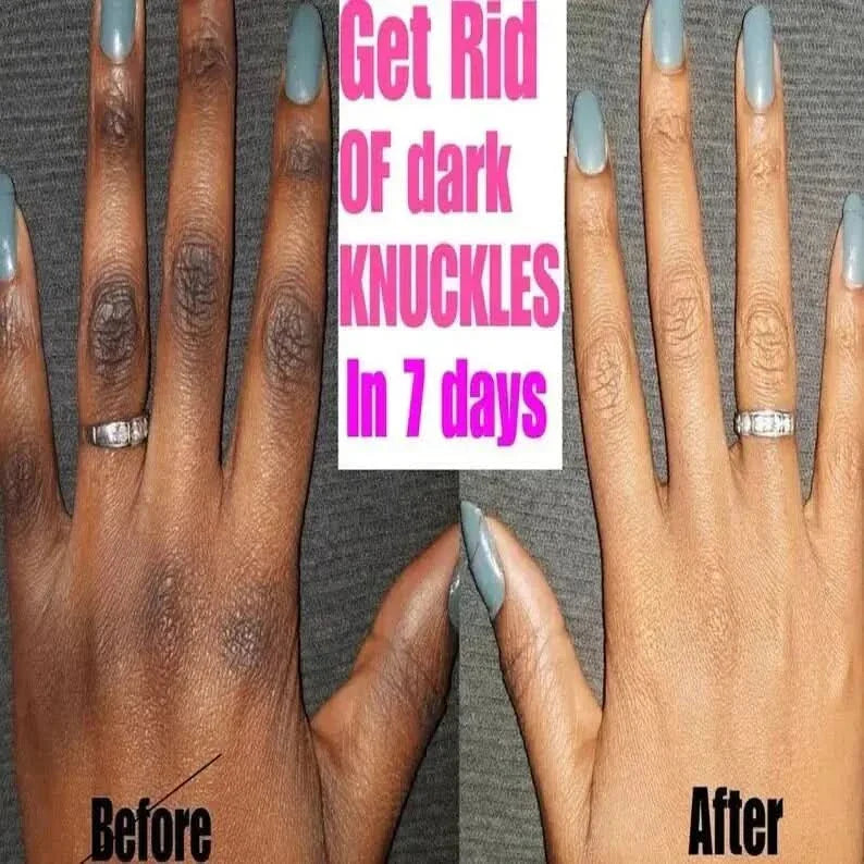 Brightening Hand Serum for Glowing Skin