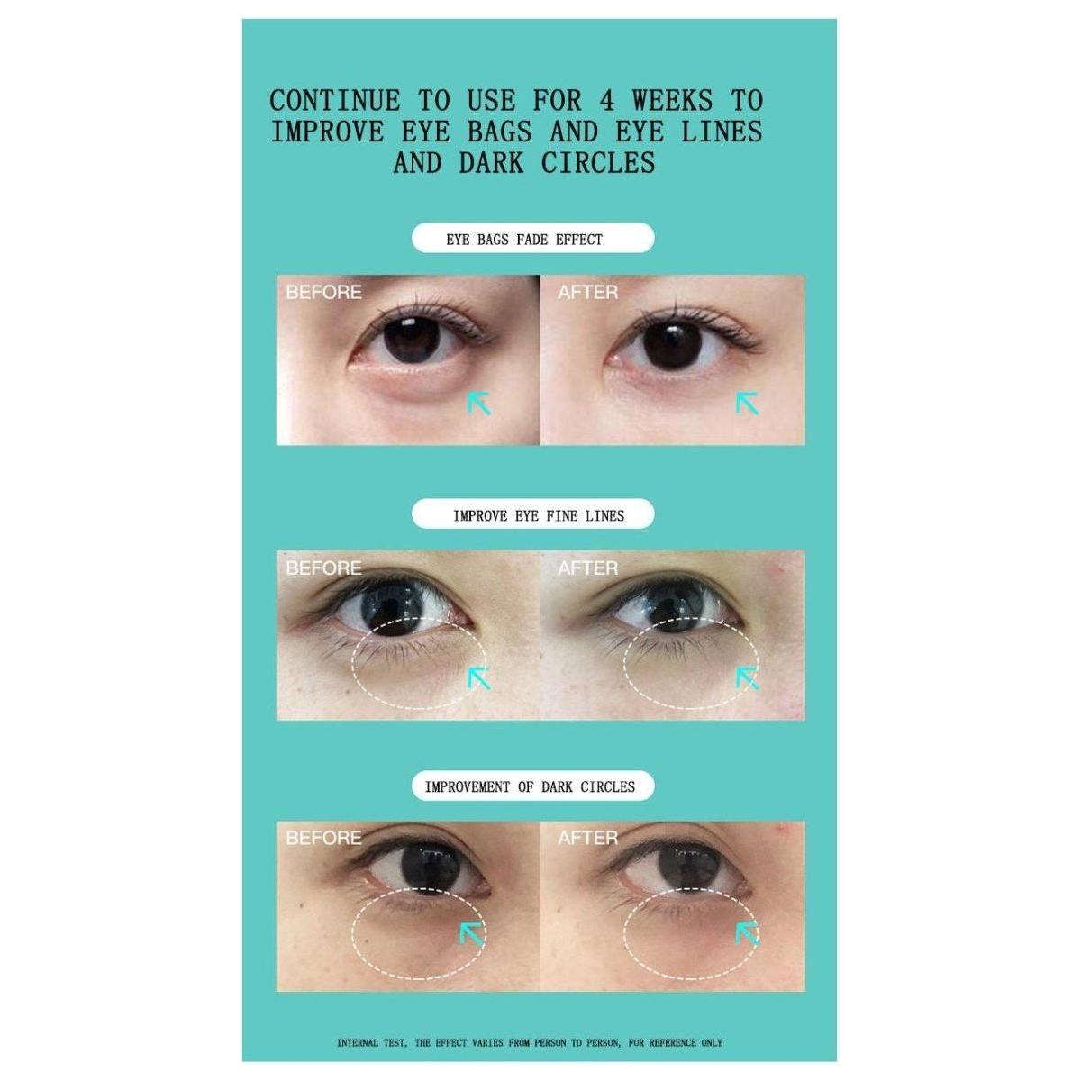 Advanced Eye Massager for Wrinkle Reduction and Dark Circles