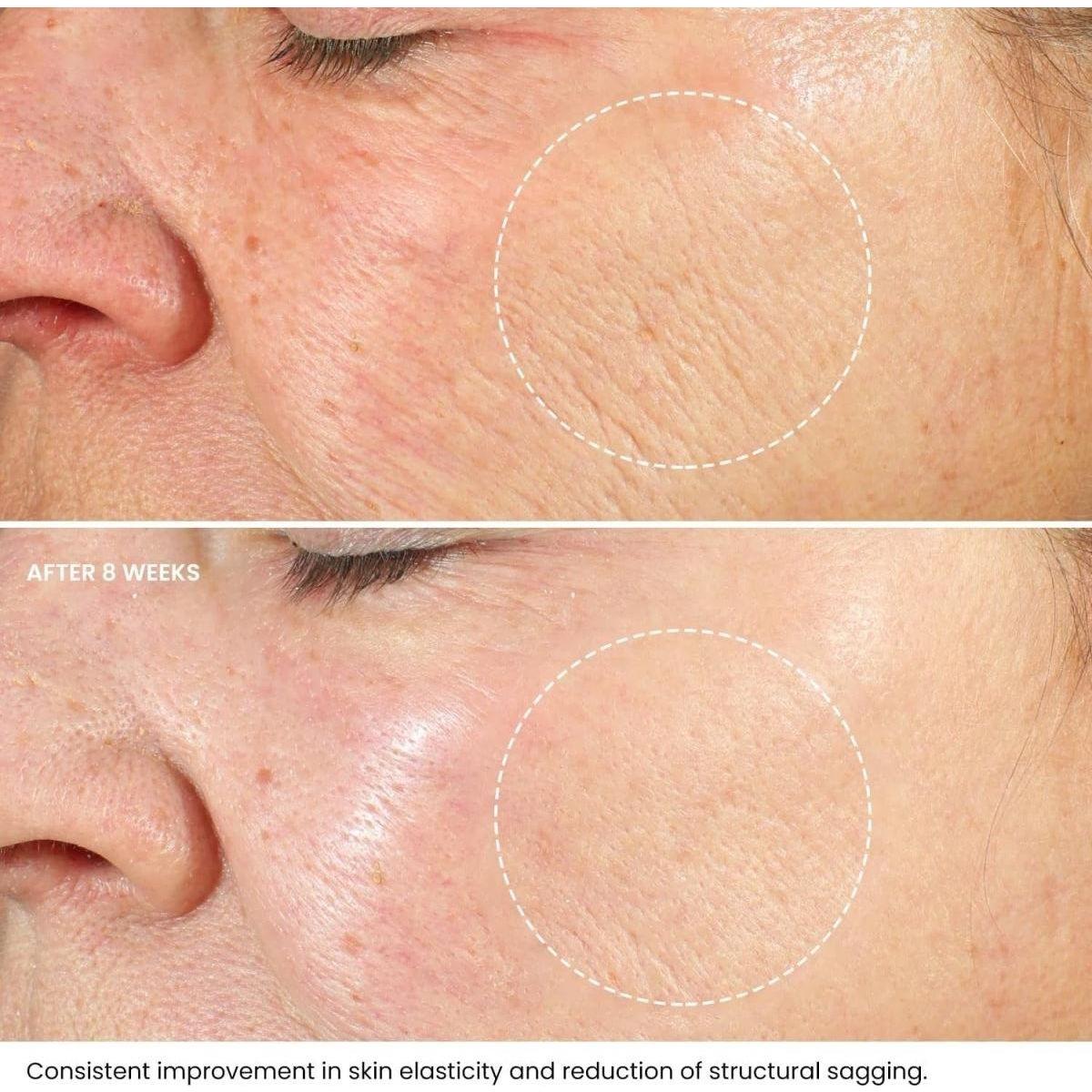 Anti Aging Retinol Face Cream 50ml