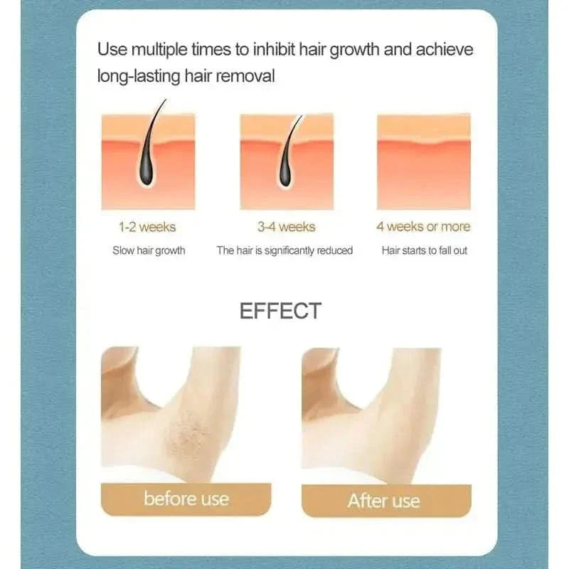 Easy At Home Permanent Hair Removal Device