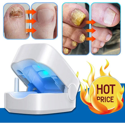 Easy At Home Nail Fungus Removal Tool