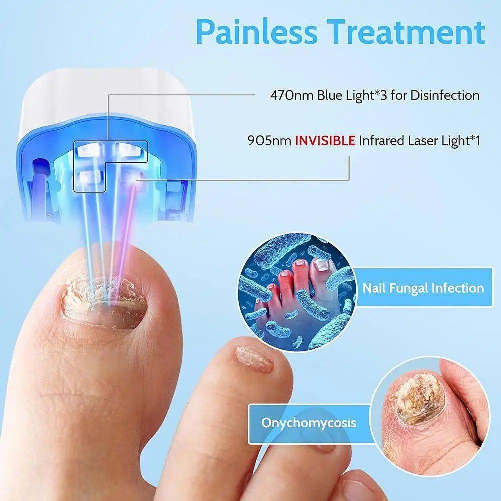Easy At Home Nail Fungus Removal Tool