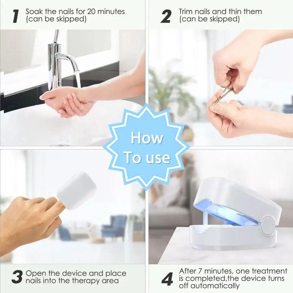 Easy At Home Nail Fungus Removal Tool
