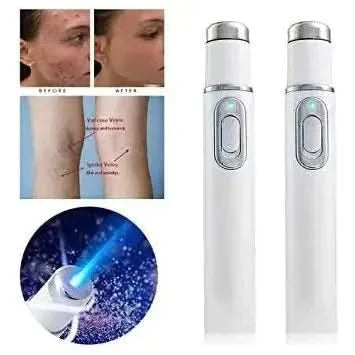 Effective Acne Light Therapy Pen for Clear Skin