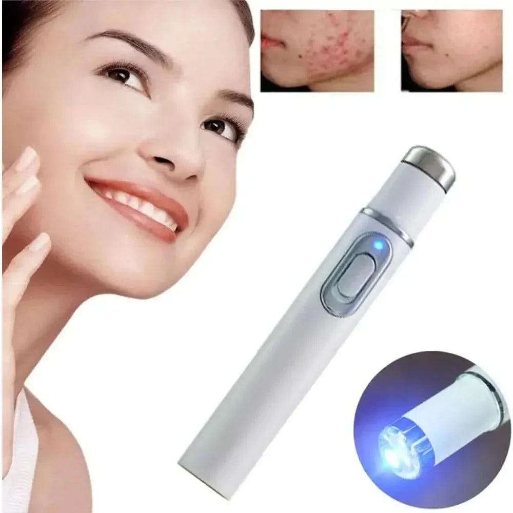 Effective Acne Light Therapy Pen for Clear Skin