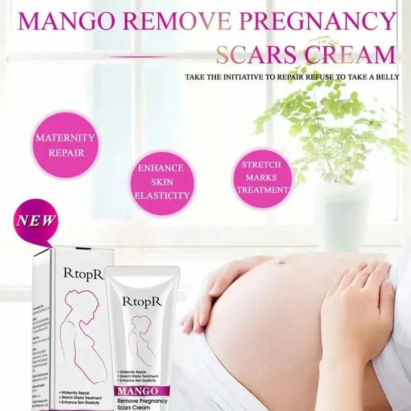 Natural Pregnancy Stretch Mark Removal Cream 40g
