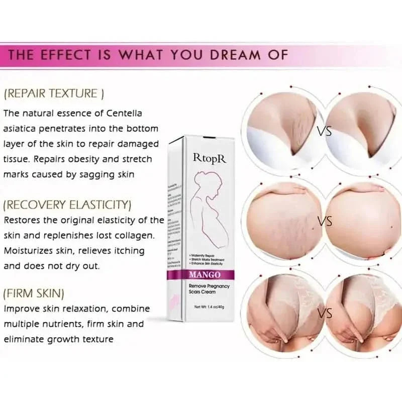 Natural Pregnancy Stretch Mark Removal Cream 40g