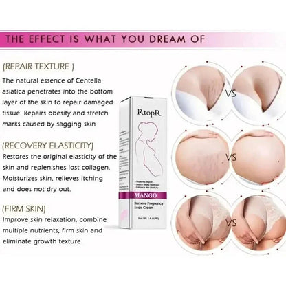 Natural Pregnancy Stretch Mark Removal Cream 40g