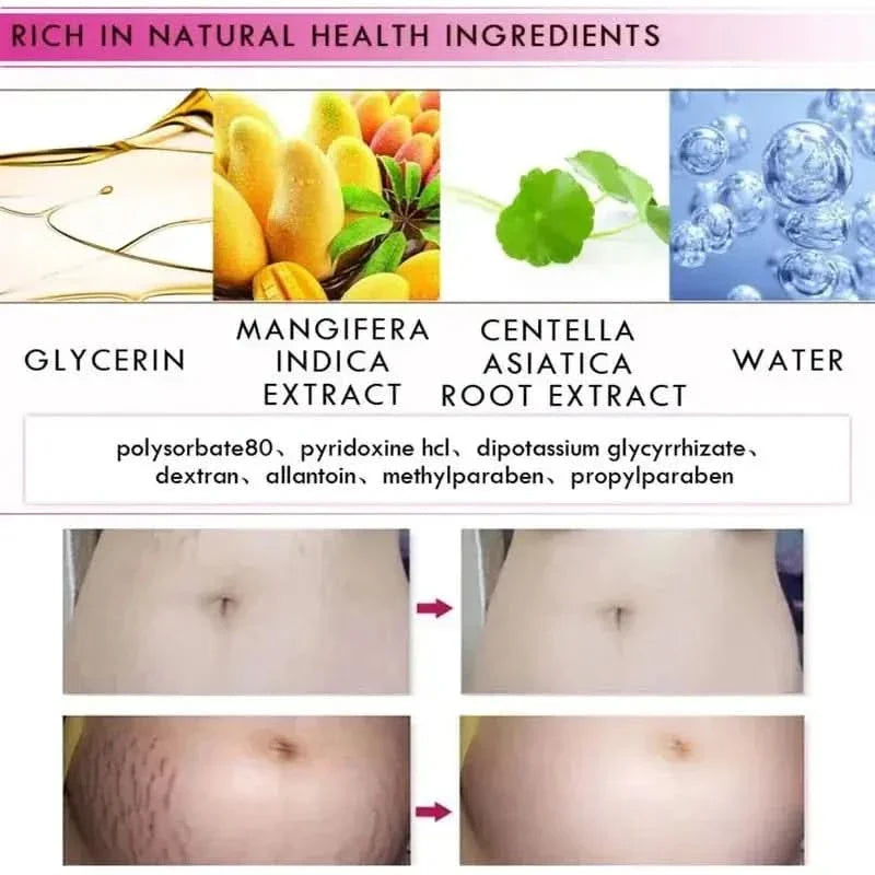 Natural Pregnancy Stretch Mark Removal Cream 40g