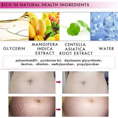 Natural Pregnancy Stretch Mark Removal Cream 40g