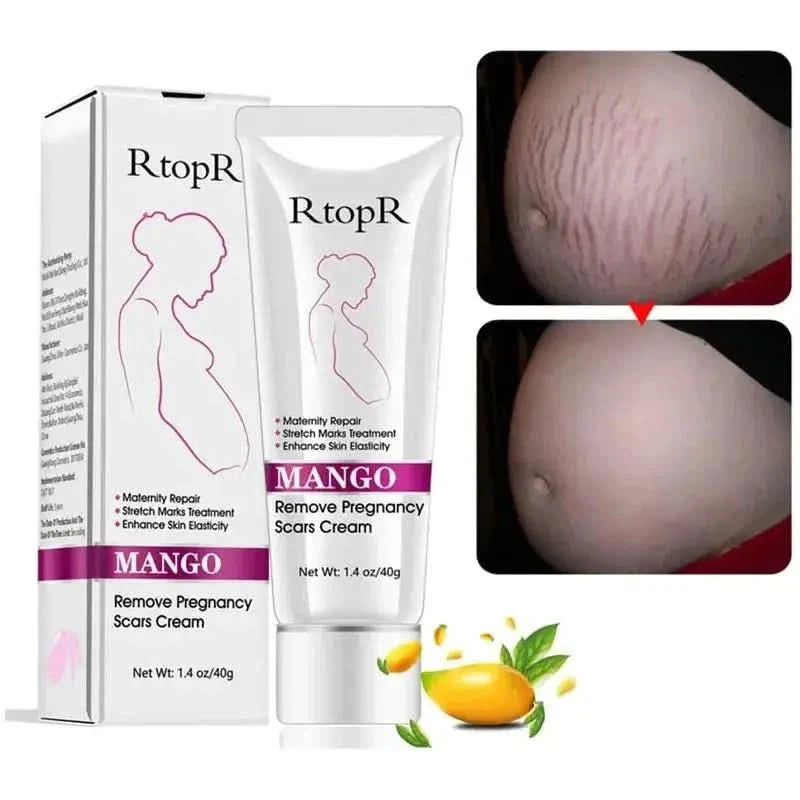 Natural Pregnancy Stretch Mark Removal Cream 40g