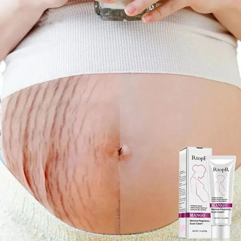 Natural Pregnancy Stretch Mark Removal Cream 40g