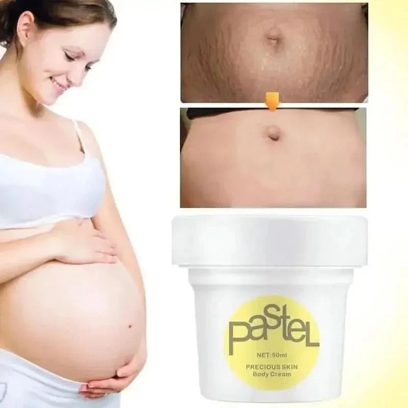 Gentle Pregnancy Stretch Mark Moisturizer Cream