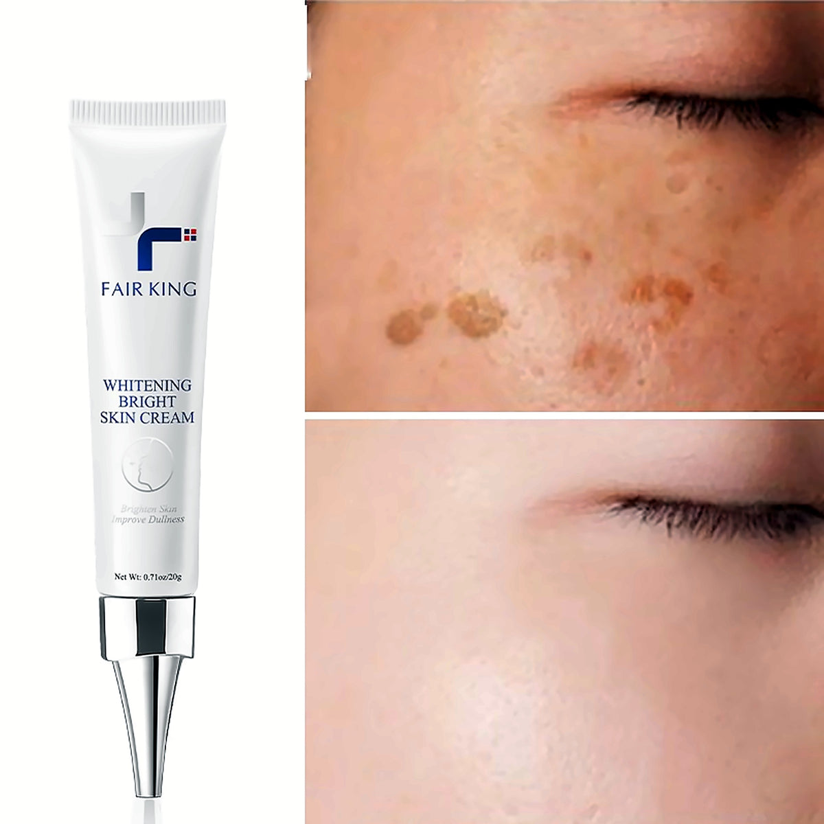Dark spot corrector cream