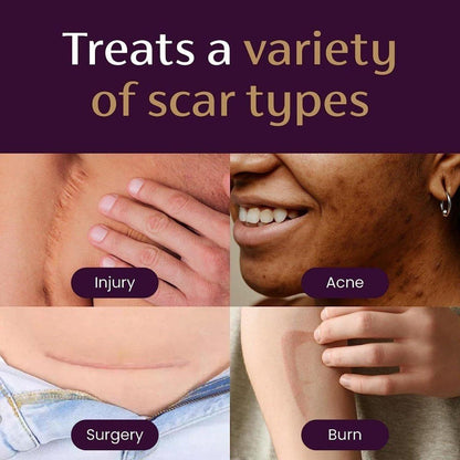 Effective Scar Removal Gel for Acne and Burn Scars