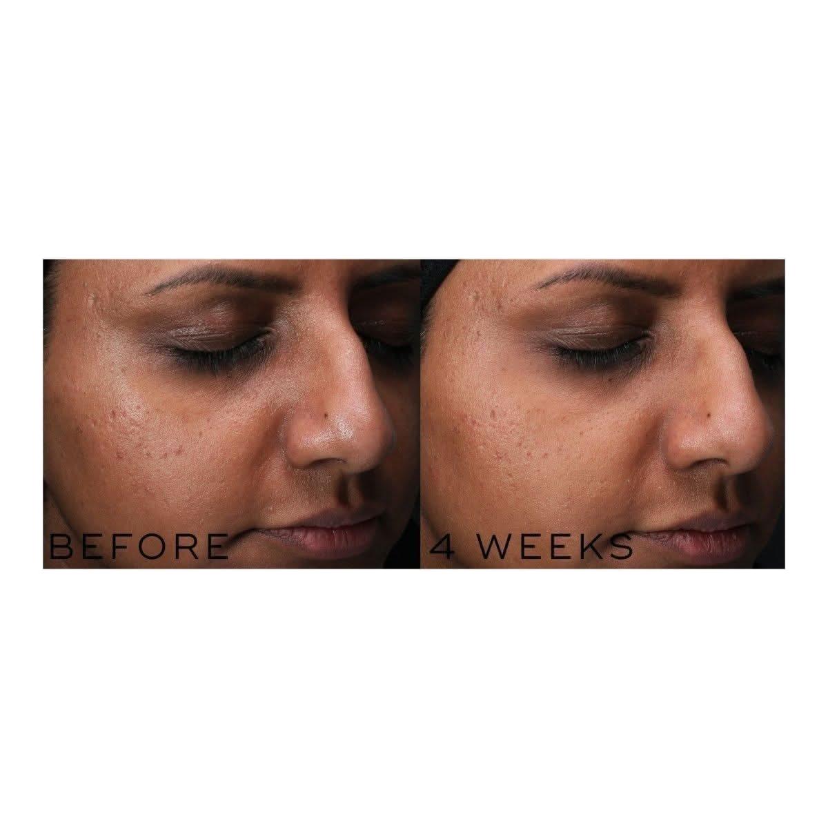 Glowing Skin Niacinamide Serum 30ml