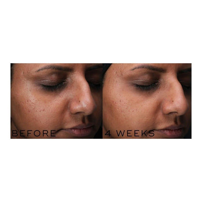 Glowing Skin Niacinamide Serum 30ml