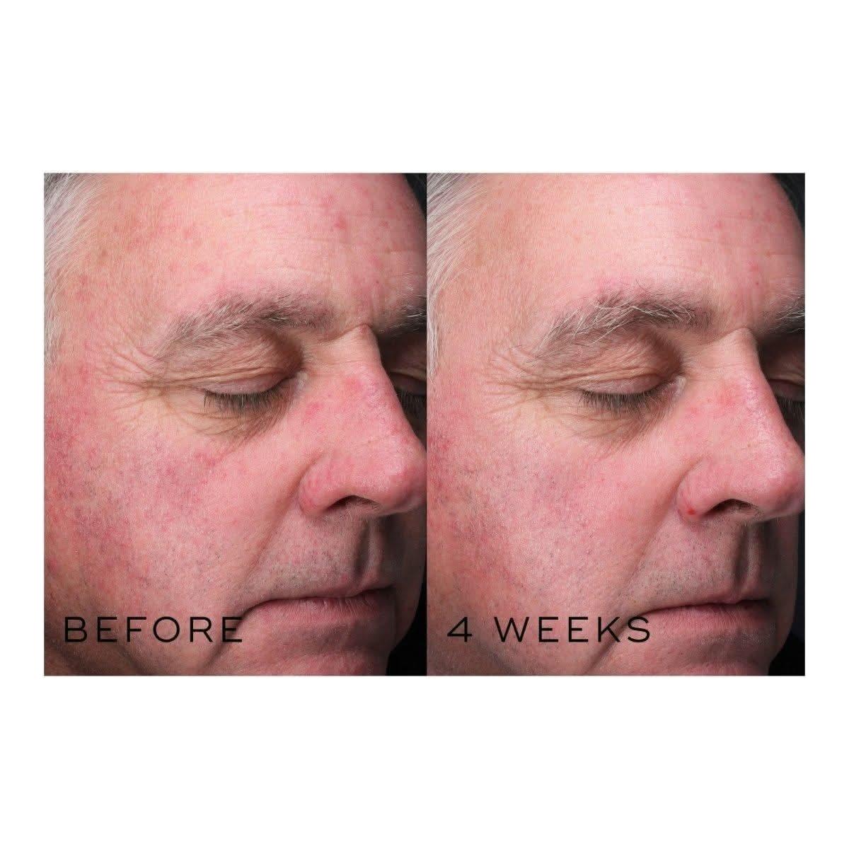 Glowing Skin Niacinamide Serum 30ml