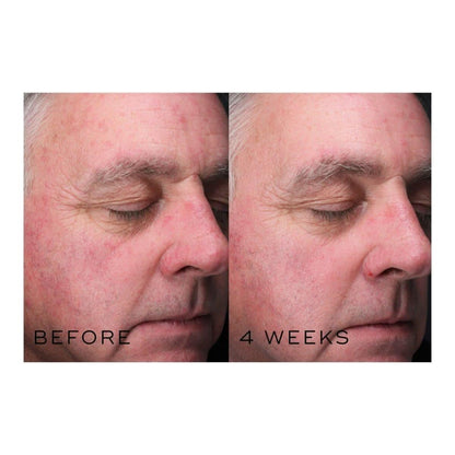 Glowing Skin Niacinamide Serum 30ml