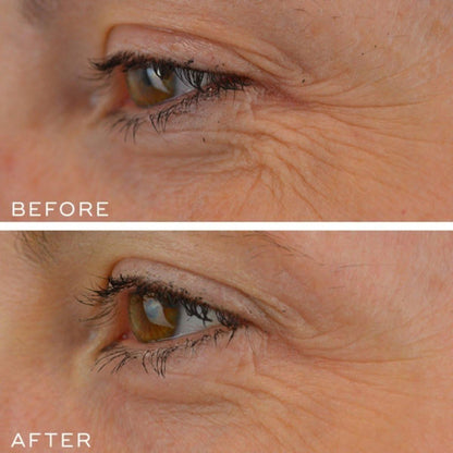 Powerful Anti-Aging Retinal Serum 30ml