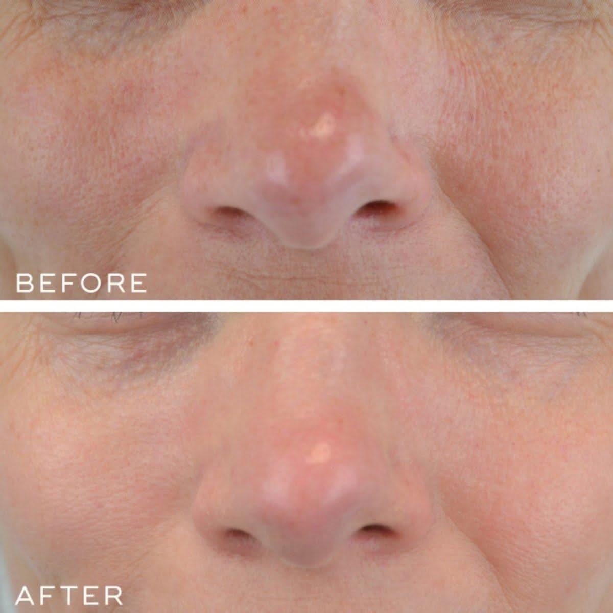 Powerful Anti-Aging Retinal Serum 30ml