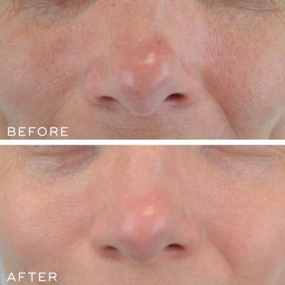 Powerful Anti-Aging Retinal Serum 30ml