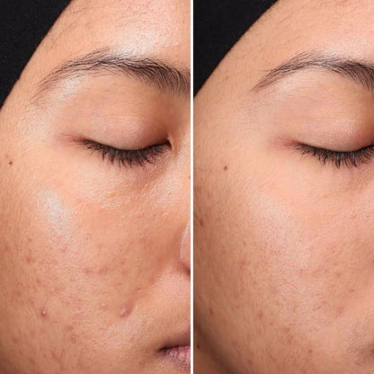 Daily Exfoliating Toner for Smooth Balanced Skin