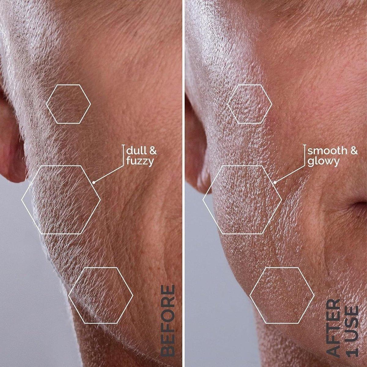 Professional At Home Dermaplaning Tool