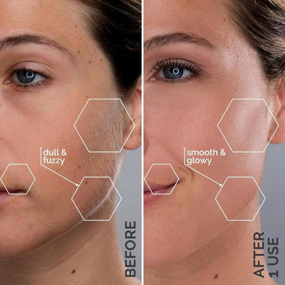 Professional At Home Dermaplaning Tool