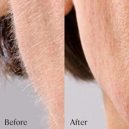Dermaplaning Pro Replacement Kit