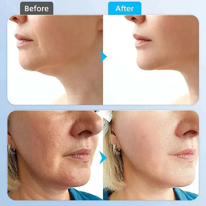 Rejuvenating Facial Massager for Anti Aging Skin