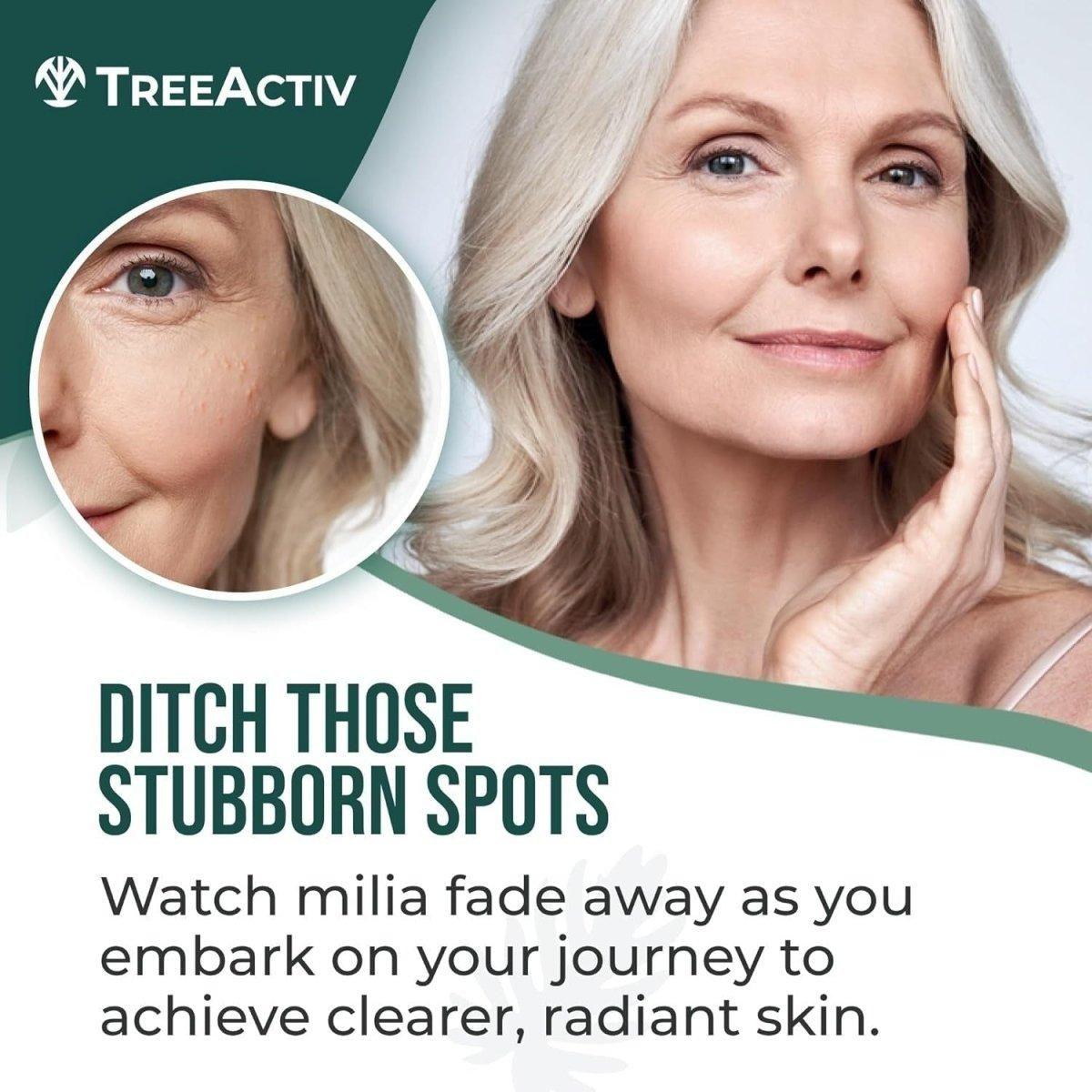 Effective Spot Cream for Acne and Milia Removal