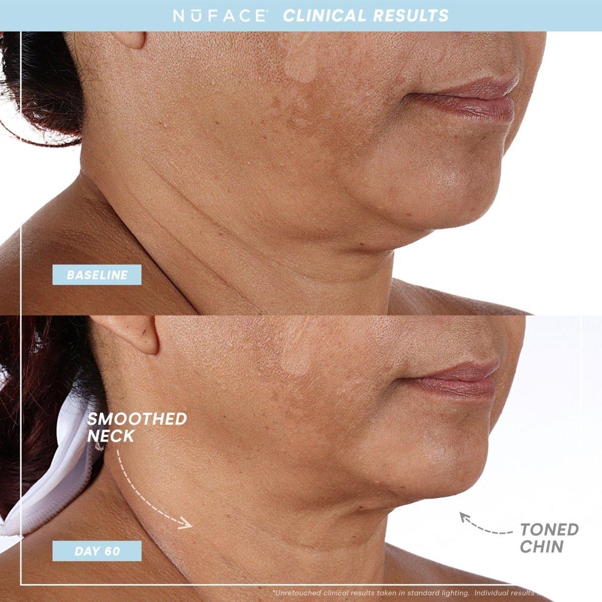 Compact Anti Aging Facial Toner Device Kit